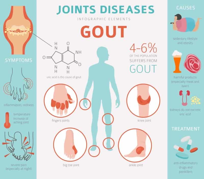 Gout Management
