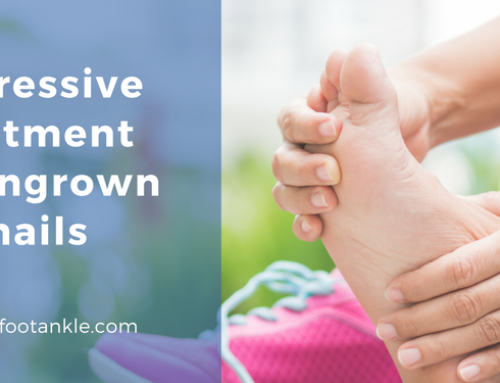 Treatment of Ingrown Toenails