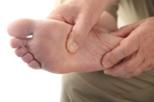 close up of the bottom of a man's foot for Plantar Fasciitis